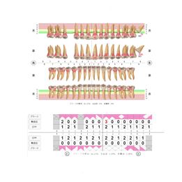 歯と歯ぐきの基本検査